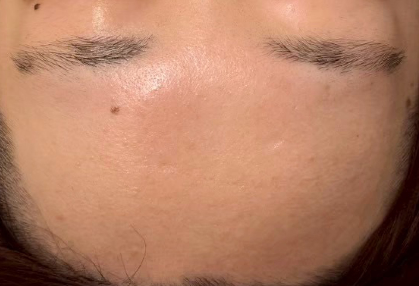 After
