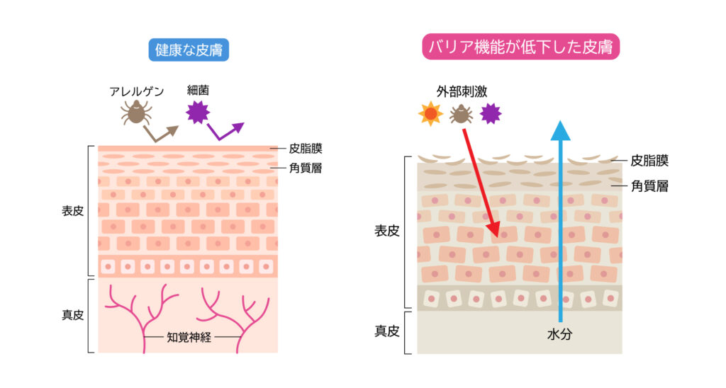 正常な肌　バリア機能低下の肌